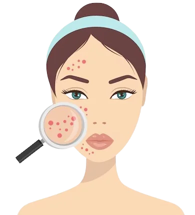 ত্বক ফর্সা ও উজ্জ্বল করে এবং ব্রণ, দাগ ও মেছতা হালকা করে